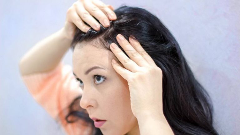 Saç Derisindeki Problemlere Doğal Maske